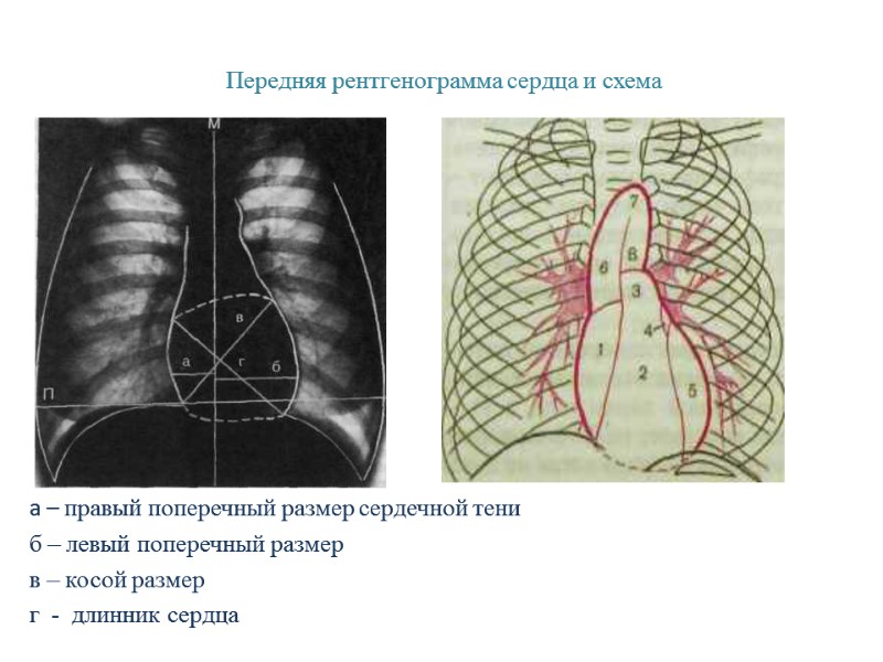 Передняя рентгенограмма сердца и схема        а –